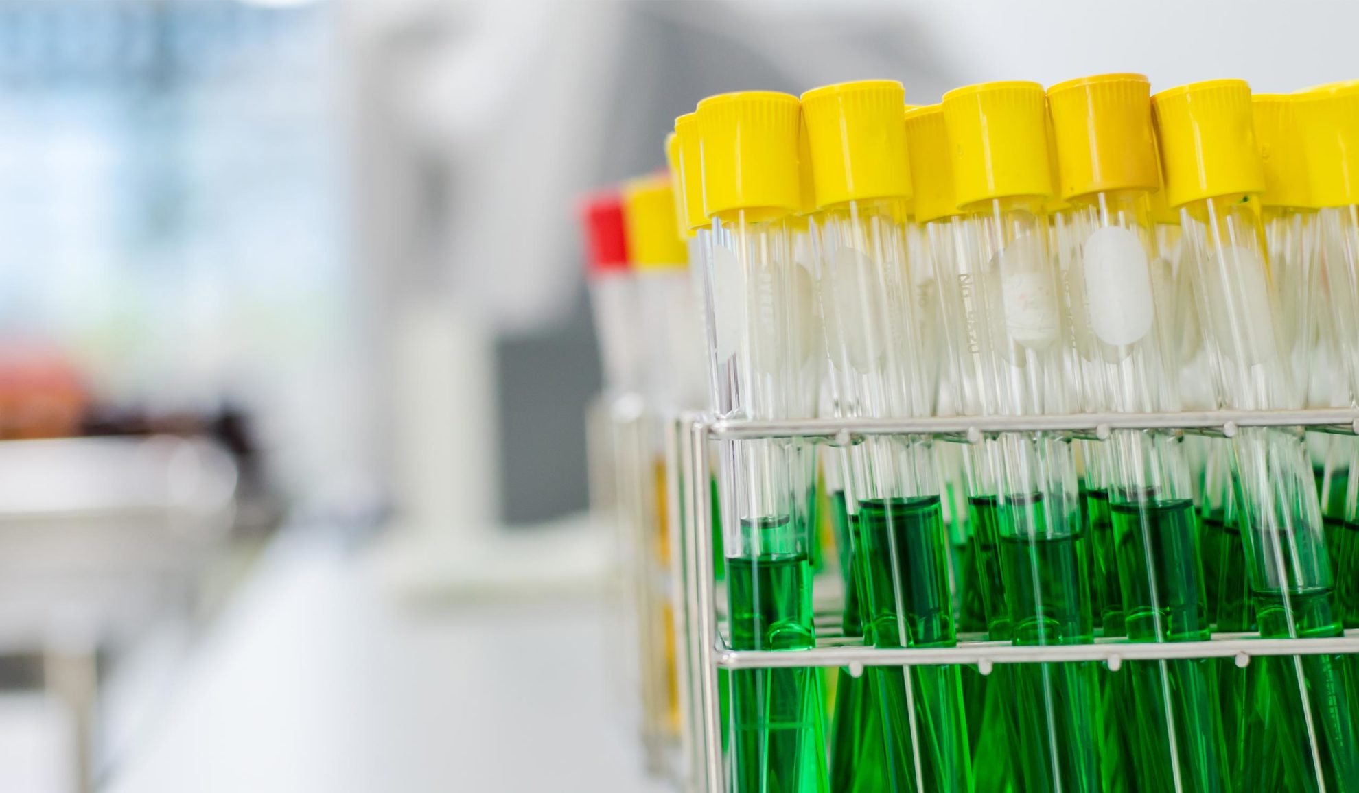 testtubes-with-green-liquid-in-lab-nashville-tn